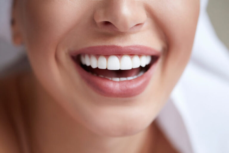 Cosmetic Dentistry Buckhead Dental Group Atlanta, GA